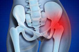 Des prothèses non-conformes mais pas défectueuses