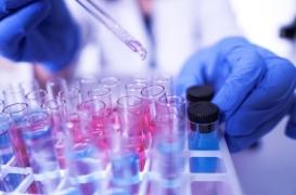 Le virus de Marburg doit-il inquiéter ? 