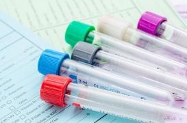 Hépatites : 60 000 nouvelles infections en 2015