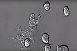 VIDEO. Comment meurent nos globules blancs