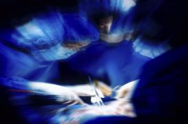 Greffe de tête : un russe se porte candidat