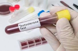 L'atlhète Caster Semenya condamnée à suivre un traitement : qu'est-ce que l'hyperandrogénie ?