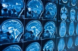 Sommeil : notre cerveau se « nettoie » pendant la nuit