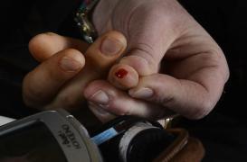 Herpès : détecter le virus avec un test sanguin