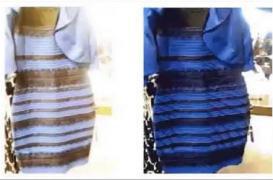 Cerveau : de nouveaux éléments sur le mystère de la robe bleue