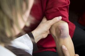 Hémophilie : un anticorps réduit les saignements de 87 %