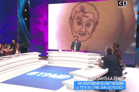 Détatouage : “Il m’aura fallu presque 4 ans pour effacer le visage de Cyril Hanouna sur mes fesses”
