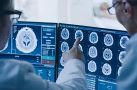 Cancer du cerveau : reprogrammer des cellules immunitaires pour améliorer l’efficacité du traitement 