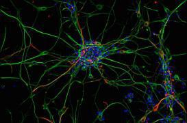 Epilepsies : vers la sortie de crises ?