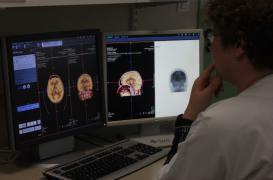 Mort subite : la grande inconnue des épilepsies 