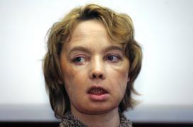 Isabelle Dinoire : décès de la première greffée du visage