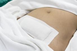 Endométriose : plus de complications après une hystérectomie