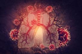 Cancer du poumon : ces signes doivent vous alerter