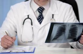 Cancer du poumon : un médicament réduit le risque de décès 