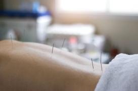 Elle vit 30 ans avec des aiguilles d’acupuncture dans la colonne vertébrale