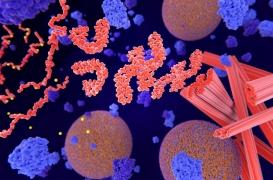 Démence : une nouvelle forme génétique rare découverte