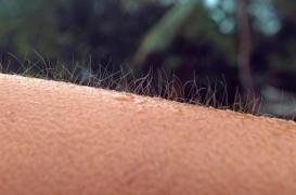 Mystère médical : quelques rares personnes parviennent à contrôler leur chair de poule