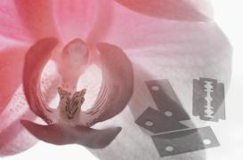 Plus de 230 millions de survivantes de mutilations génitales féminines: “un chiffre plus élevé que jamais”