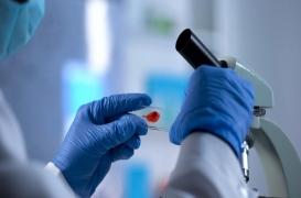 VIH : un nouveau traitement prometteur pour soigner les maladies du foie 