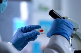 VIH : une nouvelle molécule pour empêcher la réplication du virus