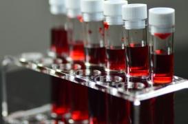 Covid-19 : les personnes du groupe sanguin O moins touchées par les formes sévères