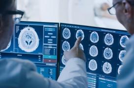 La maladie de Borna a causé 8 décès en Allemagne