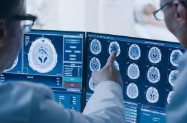 Maladie d'Alzheimer : une trop forte exposition à l'aluminium en cause ?