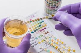 Des tests urinaires pour contrôler son alimentation