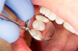 Des chercheurs ont fait pousser des dents humaines 