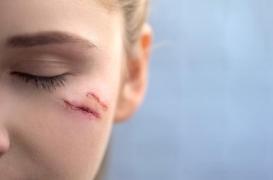 Voici ce qui protège votre visage des cicatrices 