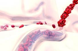 Drépanocytose : une maladie génétique pas si rare mais largement méconnue en France