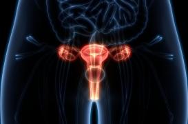 Cancer de l’ovaire : un algorithme peut identifier précocement les lésions à haut risque