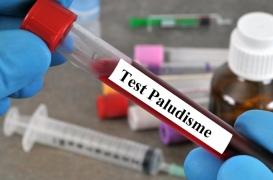 Journée mondiale du paludisme : où en est la recherche ?