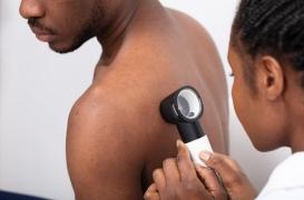 Cancer de la peau : une IA capable de détecter les mélanomes, même sur les peaux foncées