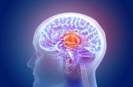 Contraception : les femmes sous pilule ont un hypothalamus plus petit