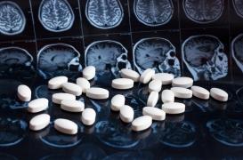 Alzheimer : une étude met en avant l’efficacité de ces médicaments déremboursés en France