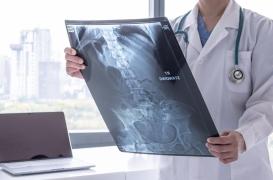 Cancer de l'estomac : un combat crucial contre un ennemi sournois et tardif