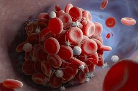 Une nouvelle technique pour repérer les caillots sanguins