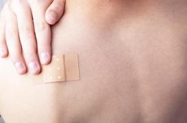Cancer de la peau : bientôt un patch pour le traiter