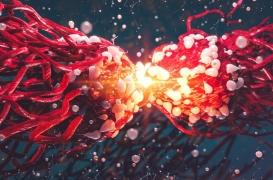 Mélanome : le gène qui génère une résistance à l’immunothérapie a été identifié