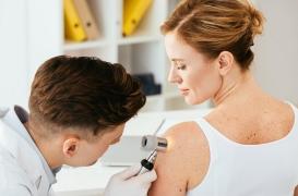 Les grains de beauté : à surveiller !