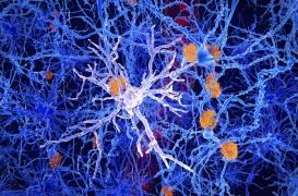 Alzheimer: pourquoi les neurones de la mémoire sont les plus vulnérables à la maladie?