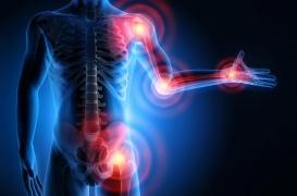 Polyarthrite rhumatoïde : cibler le microbiote permettrait de la soulager