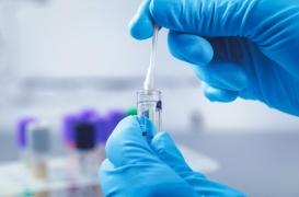 Tests ADN : faut-il enfin lever l’interdit en France ?