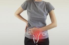 Dépistage du cancer du col de l'utérus : la campagne qui fait scandale en Grande Bretagne