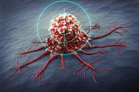 Métastases dans le cancer du sein : comment les cellules agressives se développent en se cachant 