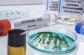 Listériose : pourquoi les cas augmentent depuis 2021 ? 