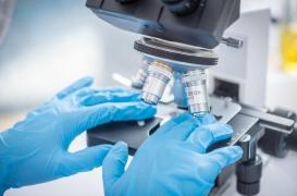 Variole du singe : une forme grave du Mpox menace les malades du sida