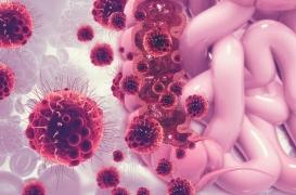 Cancer colorectal : une nouvelle cible thérapeutique pour inhiber la progression des tumeurs