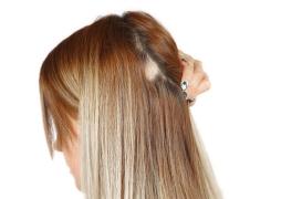 La star de Riverdale Lili Reinhart souffre d’alopécie